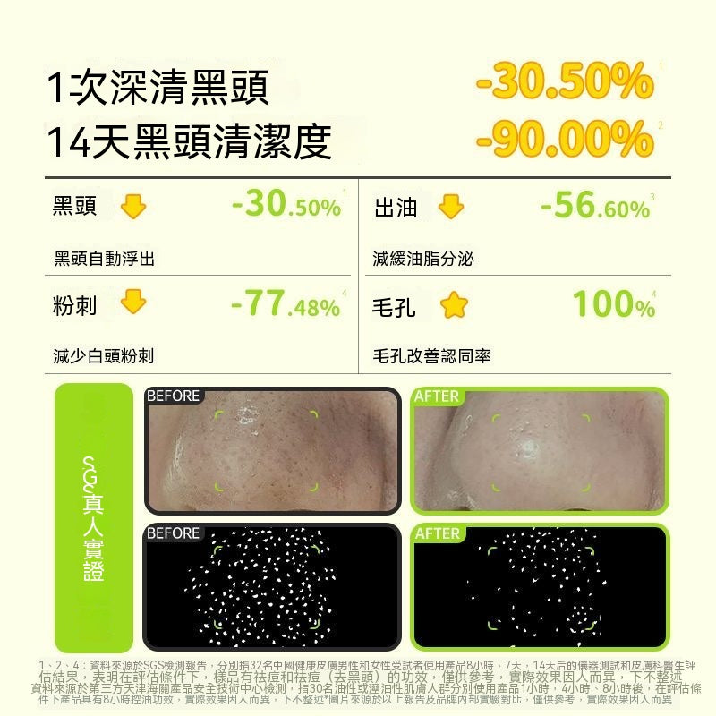 ilso蠟筆小新聯名黑頭導出液套組