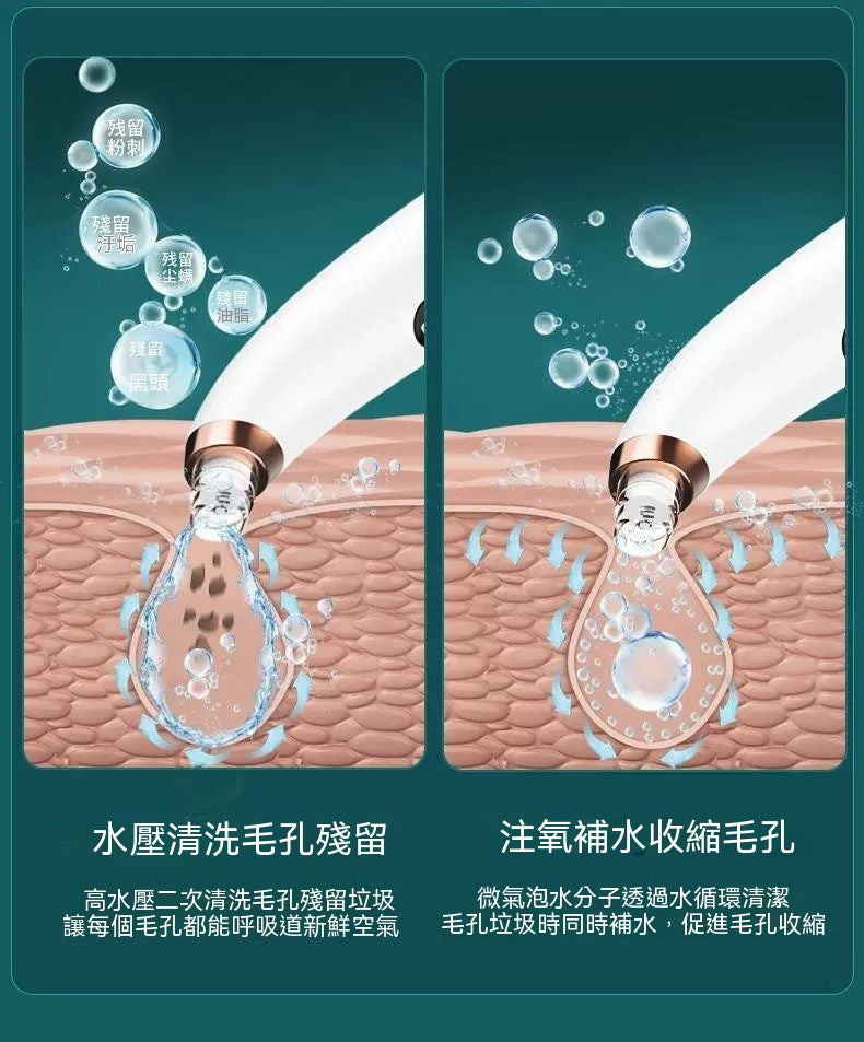 小氣泡清潔黑頭儀