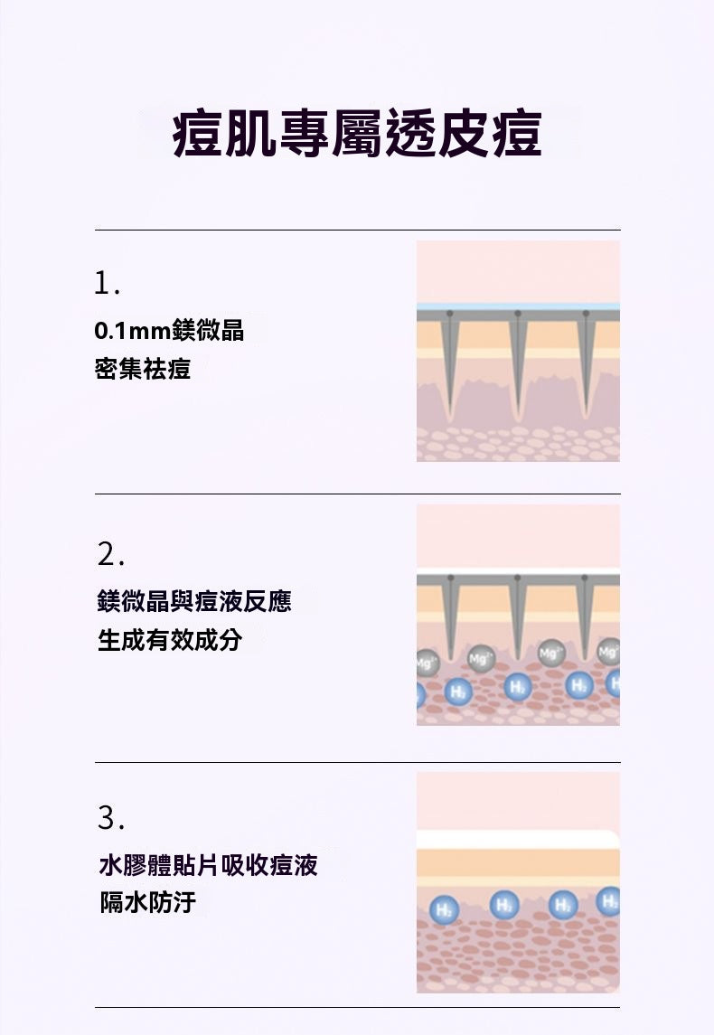 韓國微晶痘痘貼