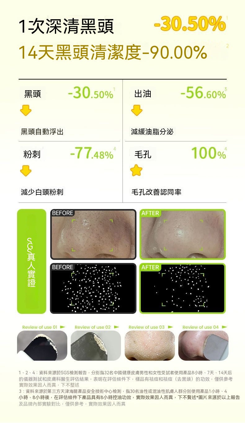 ilso蠟筆小新聯名黑頭導出液套組